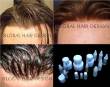 Protesi capelli di nuova generazione in lace e pellicola, capelli , Alopecia, prodotti per la cura